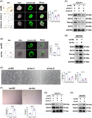 Feedback loop LINC00511–YTHDF2–SOX2 regulatory network drives cholangiocarcinoma progression and stemness