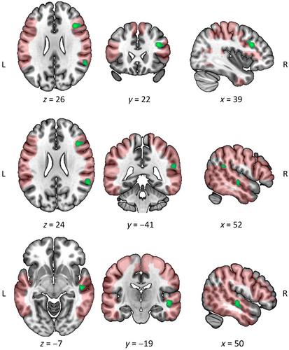 Neural Mechanisms of Social Interaction Perception: Observing Interpersonal Synchrony Modulates Action Observation Network Activation and Is Spared in Autism