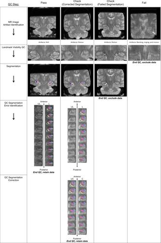 A (sub)field guide to quality control in hippocampal subfield segmentation on high-resolution T2-weighted MRI