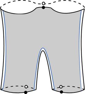 Knot Floer homology and surgery on equivariant knots