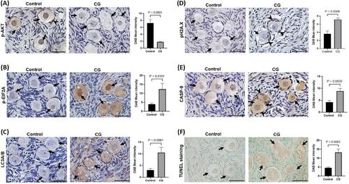 Single-nucleus and spatial transcriptomics of paediatric ovary: Molecular insights into the dysregulated signalling pathways underlying premature ovarian insufficiency in classic galactosemia