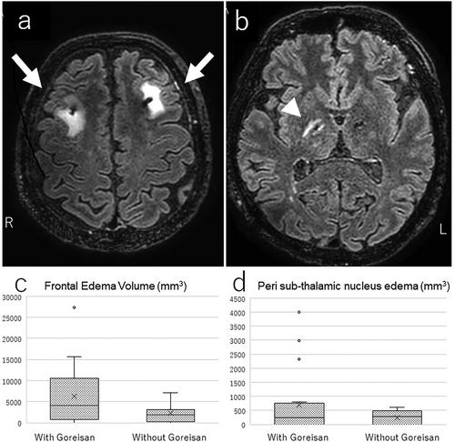 Effects of Goreisan in the Perioperative Period of Subthalamic Deep Brain Stimulation in Parkinson's Disease