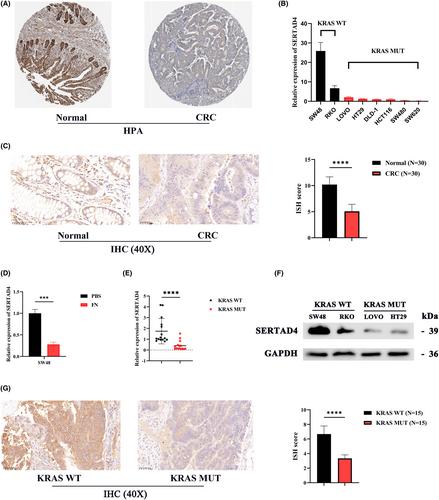 KRAS mutation promotes the colonization of Fusobacterium nucleatum in colorectal cancer by down-regulating SERTAD4