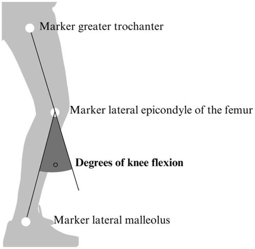 Successful ACL repair by dynamic intraligamentary stabilisation is non-inferior in functional performance and worse in proprioception compared to healthy controls in a case-matched study