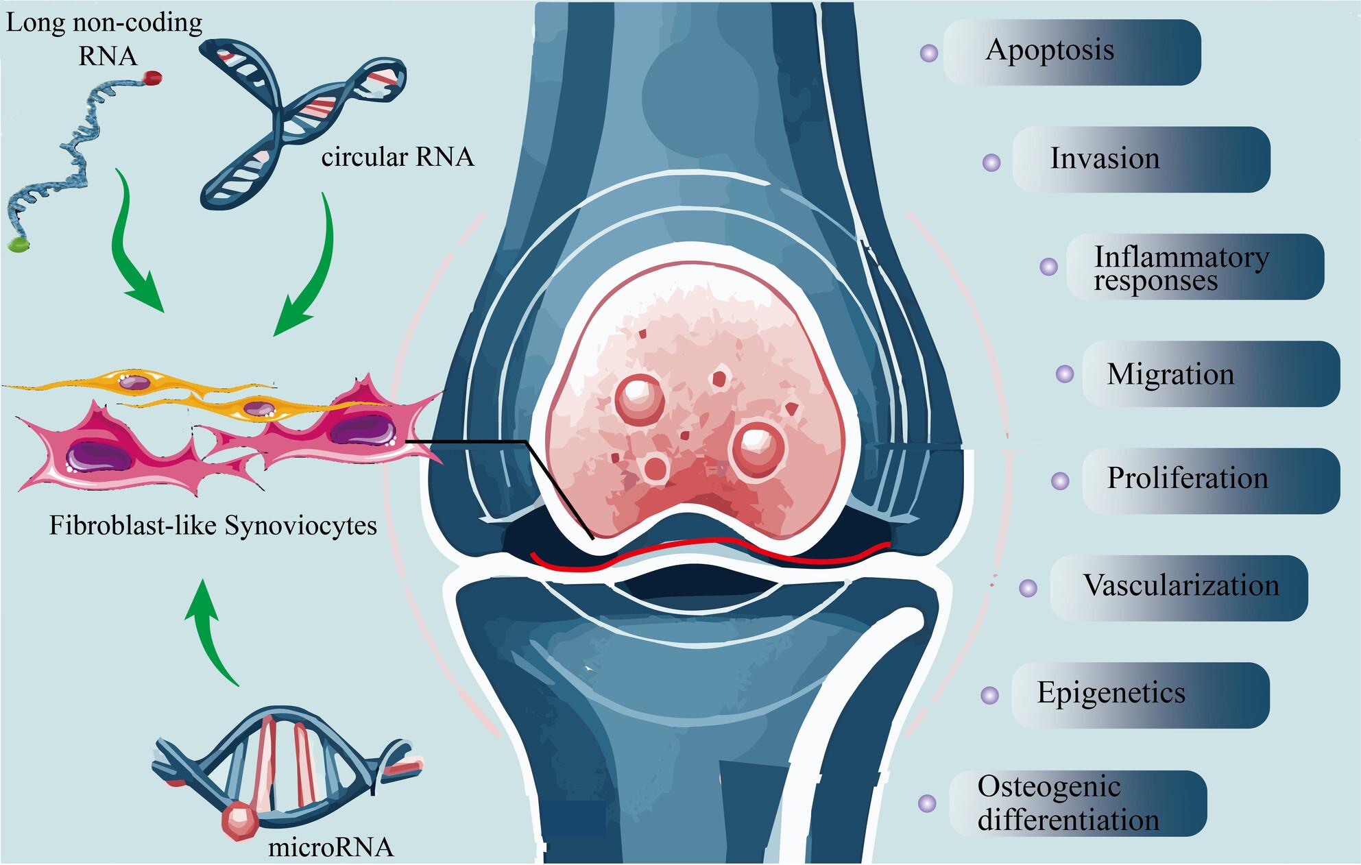 The role of non-coding RNAs in fibroblast-like synoviocytes in rheumatoid arthritis