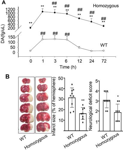 The Dopamine Transporter Is a New Target for Ischemic Stroke