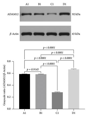 Unveiling miRNA30b’s Role in Suppressing ADAM12 to Combat Triple-Negative Breast Cancer