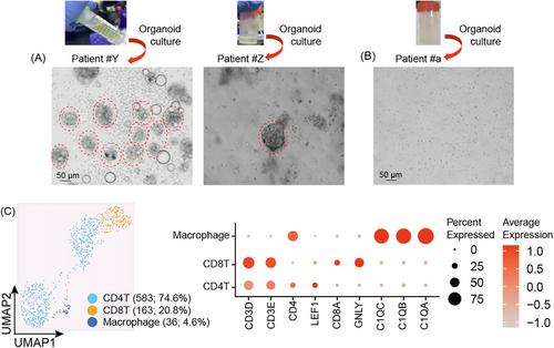 Organoid-driven diagrammatic devolution: Elevating precision in pancreatic cystic lesions diagnosis