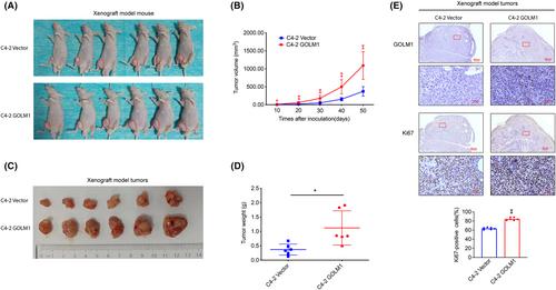 GOLM1 promotes prostate cancer progression via interaction with PSMD1 and enhancing AR-driven transcriptional activation