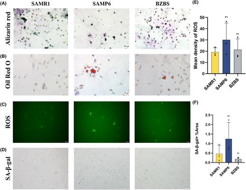 Bazi Bushen attenuates osteoporosis in SAMP6 mice by regulating PI3K-AKT and apoptosis pathways