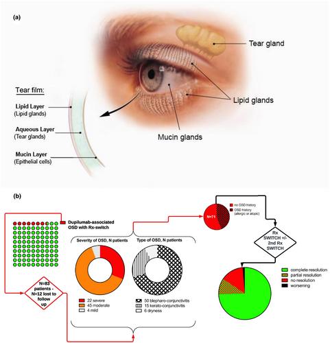 Fears for tears? Targeted therapies for atopic dermatitis and ocular surface health