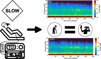 Overcoming age: Slow anesthesia induction may prevent geriatric patients from developing burst suppression and help developing intraoperative EEG signatures of a younger brain