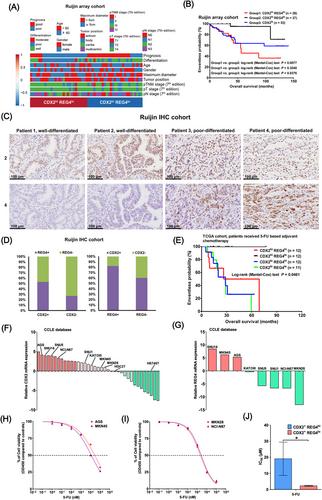 Targeting CBP revers chemoresistance to 5-FU of CDX2/REG4 double-positive gastric cancer