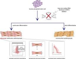 Long noncoding RNA VENTHEART is required for ventricular cardiomyocyte specification and function