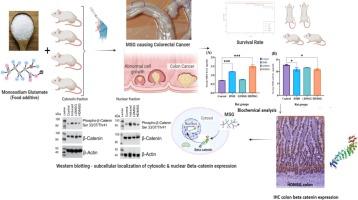 Investigating the colon toxicity and carcinogenic role of monosodium glutamate compared with Dimethylhydrazine in male Wistar rats: Exploring the link to childhood colon cancer risk