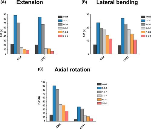 Finite element analysis of two-level discontinuous cervical hybrid revision surgery strategy to reduce biomechanical responses of adjacent segments