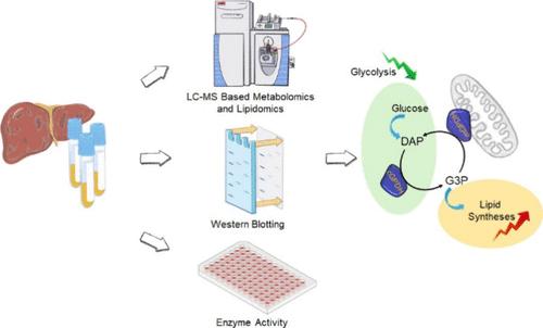 Multiomics Studies on Metabolism Changes in Alcohol-Associated Liver Disease