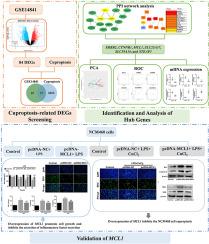 Overexpression of MCL1 attenuates irritable bowel syndrome by regulating cuproptosis: Screening and validation