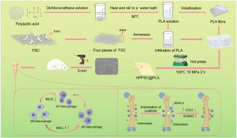 High-performance silk/polylactic acid composite scaffold material with immunomodulation and osteogenesis function