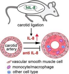 Functional characterization of human IL-8 in vascular stenosis using a novel humanized transgenic mouse model