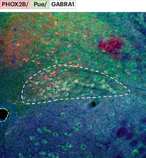 Signals from the dorsal motor nucleus of the vagus promote jejunal fat absorption