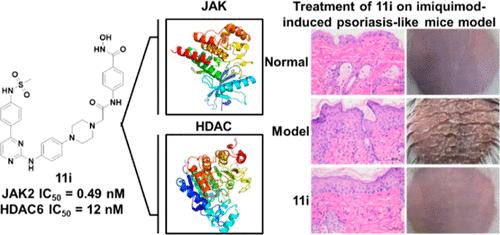 Discovery of Janus Kinase and Histone Deacetylase Dual Inhibitors as a New Strategy to Treat Psoriasis