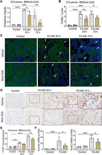 Runt-related transcription factor 1 (RUNX1) is a mediator of acute kidney injury