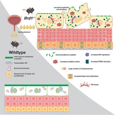 IFRD1 is required for maintenance of bladder epithelial homeostasis