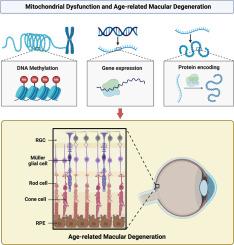 Integrative multiomic analysis unveils the molecular nexus of mitochondrial dysfunction in the pathogenesis of age-related macular degeneration