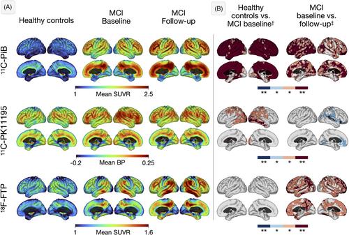 Microglial responses partially mediate the effect of Aβ on cognition in Alzheimer's disease