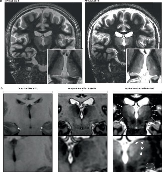 A roadmap towards standardized neuroimaging approaches for human thalamic nuclei