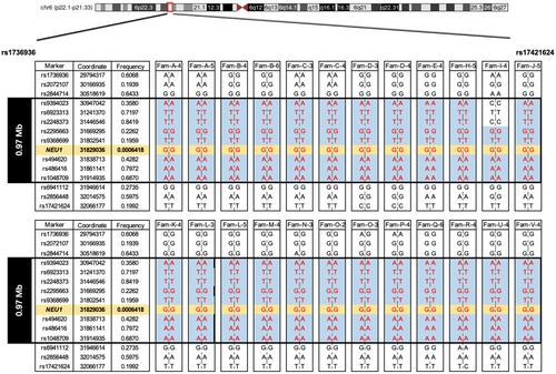 Progressive myoclonic ataxia as an initial symptom of typical type I sialidosis with NEU1 mutation.