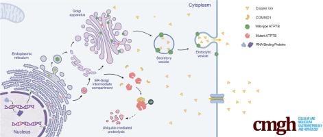 Dysfunction of ATP7B Splicing Variant Caused by Enhanced Interaction With COMMD1 in Wilson Disease