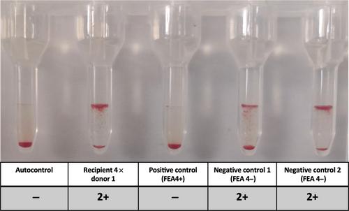 Identification of feline erythrocyte antigen 6 and lack of alloimmunization to feline erythrocyte antigen 4 in cats