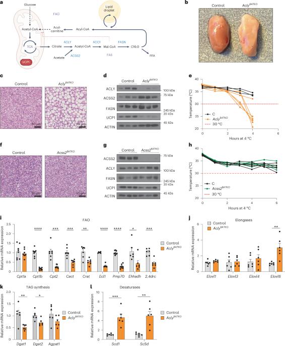 Brown fat ATP-citrate lyase links carbohydrate availability to thermogenesis and guards against metabolic stress