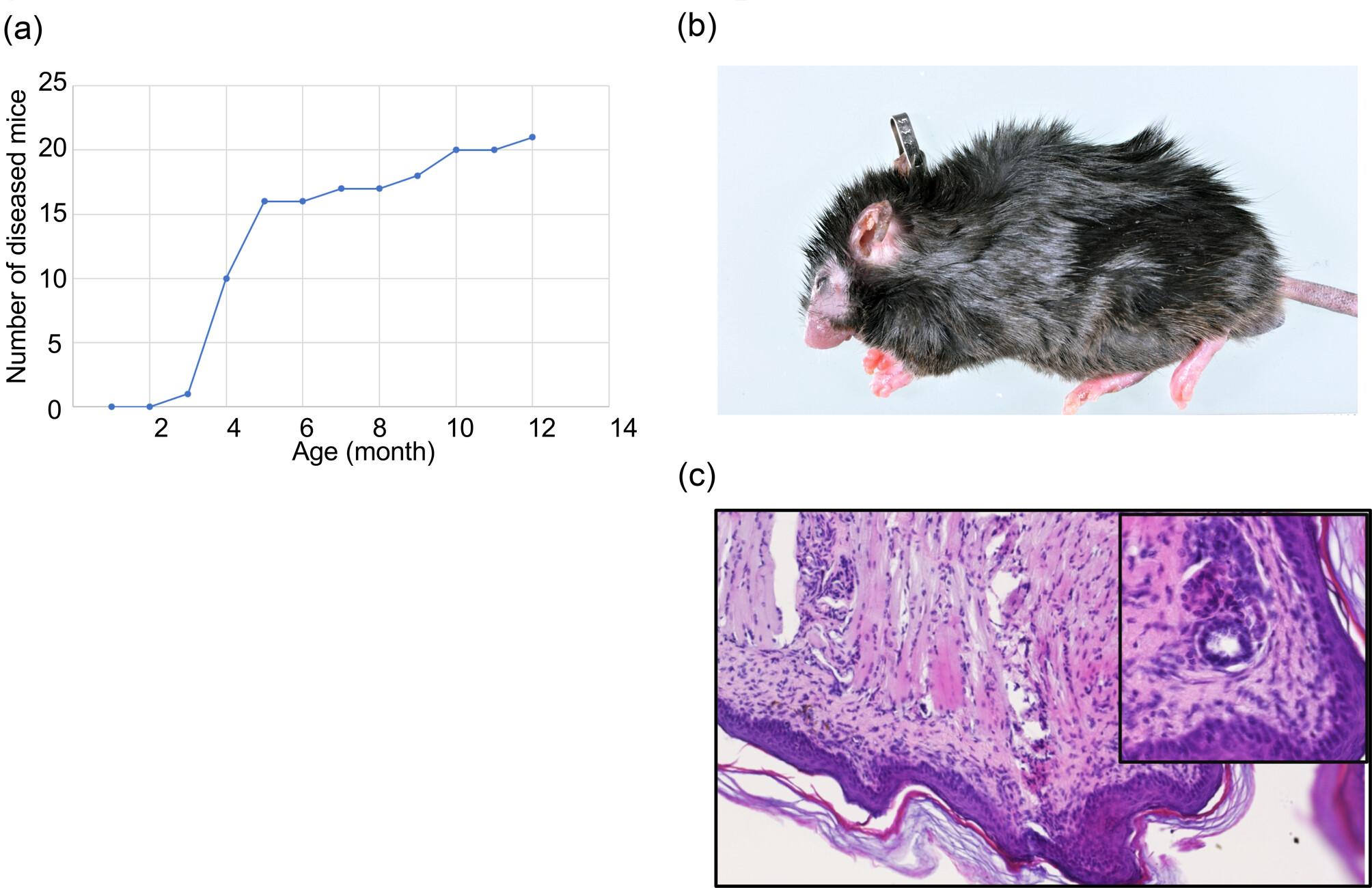 Loss of a single Zn finger, but not that of two Zn fingers, of GATA3 drives skin inflammation