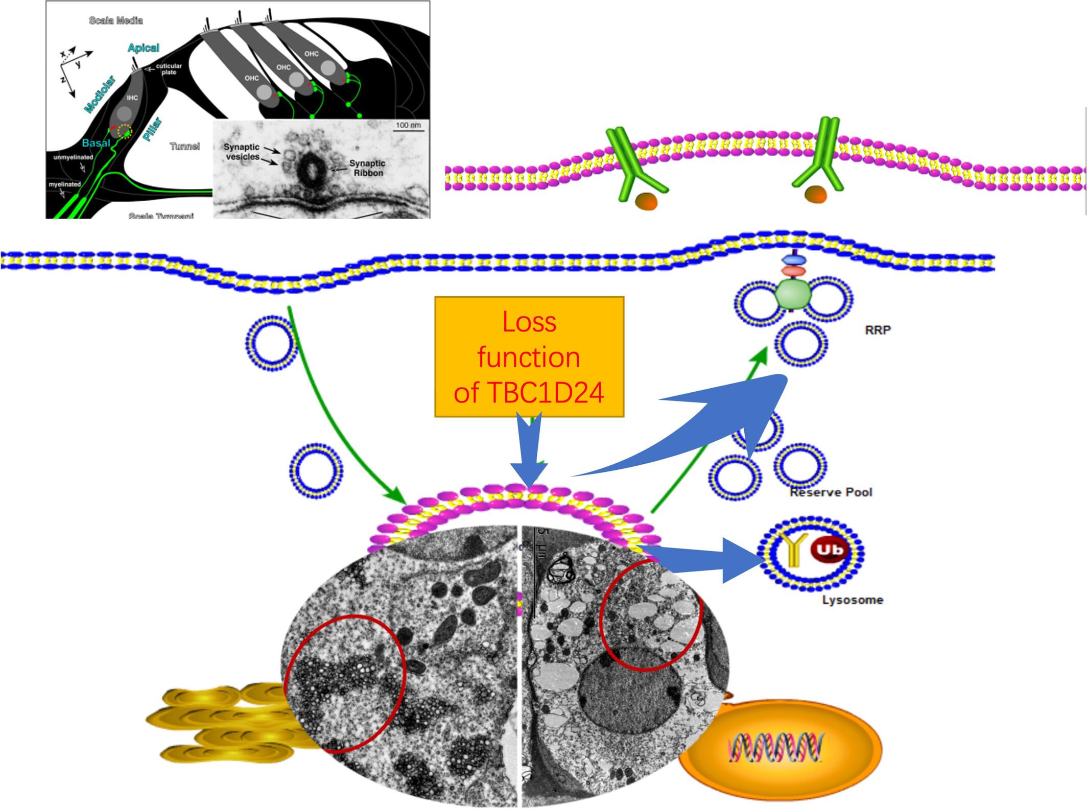 The p. S178L mutation in Tbc1d24 disrupts endosome-mediated synaptic vesicle trafficking of cochlear hair cells and leads to hearing impairment in mice