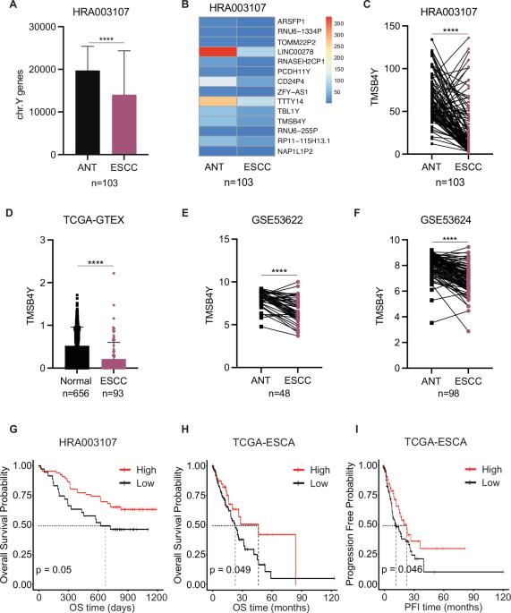 TMSB4Y restrains sphingomyelin synthesis via de novo purine synthesis to exert a tumor suppressor function in male esophageal squamous cell carcinoma