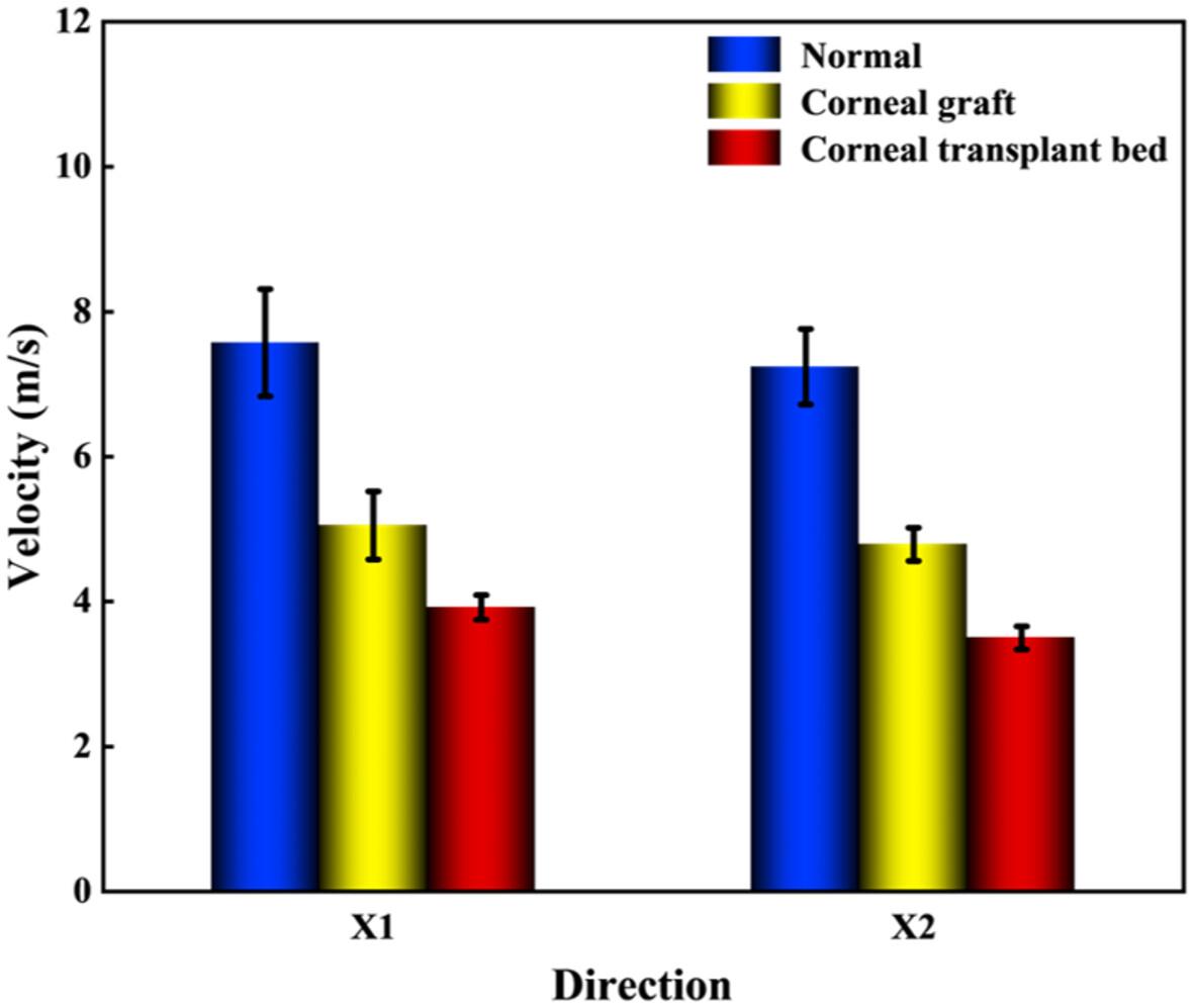 In Vivo Imaging and Evaluation of Corneal Biomechanics After Corneal Transplantation by Optical Coherence Elastography