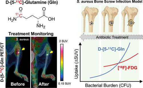 d-[5-11C]-Glutamine Positron Emission Tomography Imaging for Diagnosis and Therapeutic Monitoring of Orthopedic Implant Infections