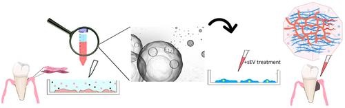 Regenerative Potential of PDL-Derived Small Extracellular Vesicles