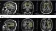 Neurocognitive correlates of cerebral mitochondrial function and energy metabolism using phosphorus magnetic resonance spectroscopy in older adults.