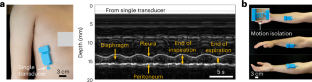 A single-transducer echomyography system for monitoring muscle activity