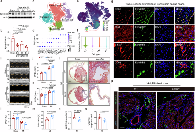 EphrinB2-mediated CDK5/ISL1 pathway enhances cardiac lymphangiogenesis and alleviates ischemic injury by resolving post-MI inflammation