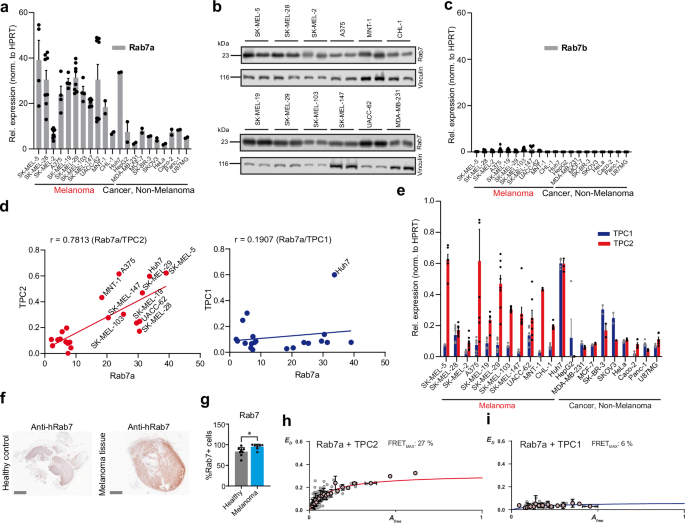 Rab7a is an enhancer of TPC2 activity regulating melanoma progression through modulation of the GSK3β/β-Catenin/MITF-axis