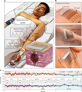 Clinical validation of a wearable ultrasound sensor of blood pressure