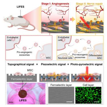 A ferroelectric living interface for fine-tuned exosome secretion toward physiology-mimetic neurovascular remodeling