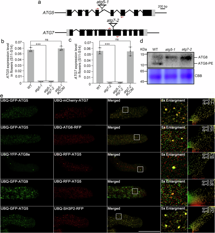 Autophagy modulates Arabidopsis male gametophyte fertility and controls actin organization