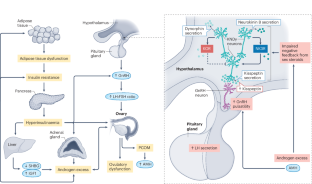 Polycystic ovary syndrome as a metabolic disease