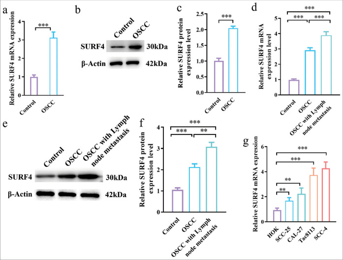 Surfeit 4 regulates aerobic glycolysis to enhanced proliferation, tumor stemness, invasion, and metastasis in oral squamous cell carcinoma.